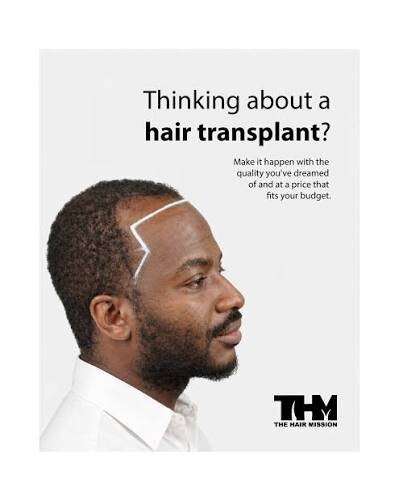 Hair transplant ad